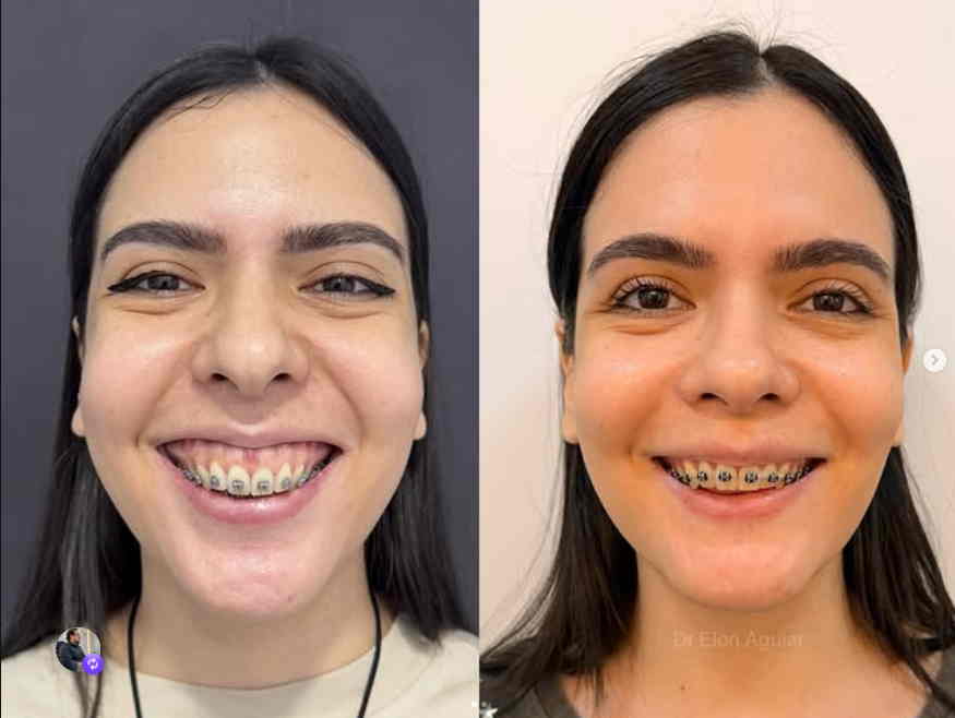 Diagnóstico de imagem para cirurgia ortognática