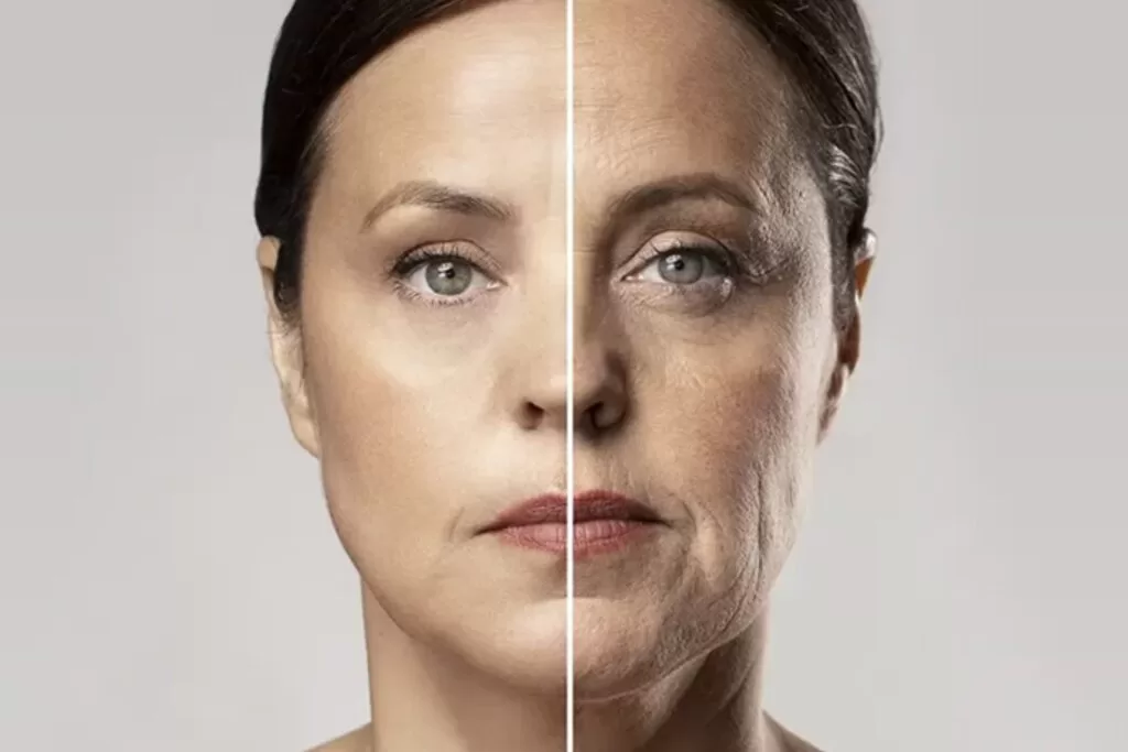 Paciente exibindo resultados de rejuvenescimento e harmonização facial na clínica SculptFace